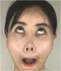顔ストレッチ