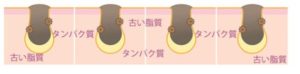 角栓とは